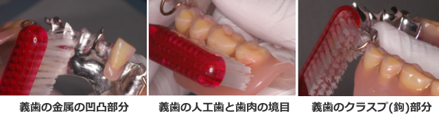 義歯の清掃